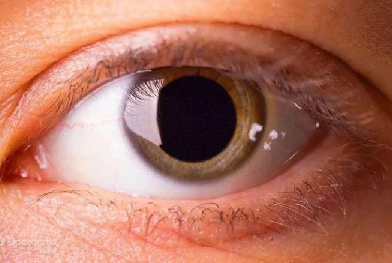 1739352736.689355_447163_image